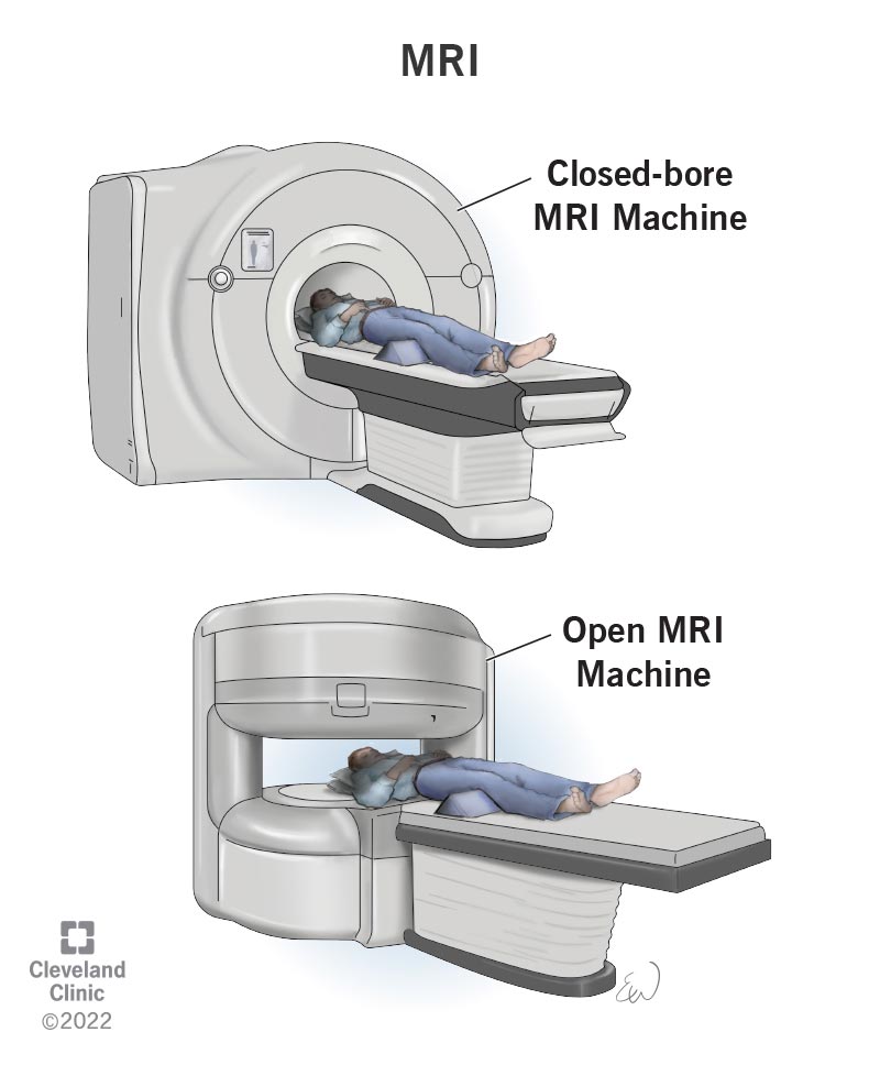 Closed and open MRI machine diagram
